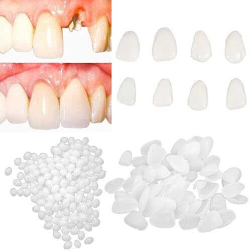 Fake Tooth Repair Kits DIY Dental Care Kit Glue for Filling Missing Broken