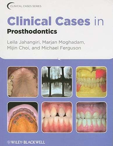 Clinical Cases in Prosthodontics by Leila Jahangiri: Used