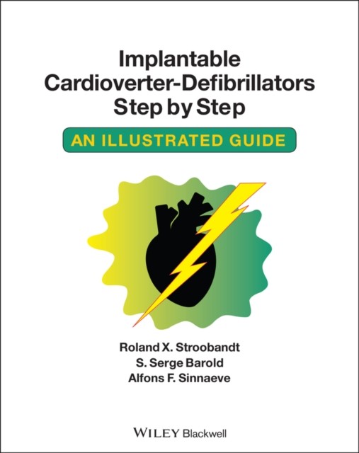 Implantable Cardioverter  Defibrillators Step  by Alfons F. Sinnaeve PAPERBACK