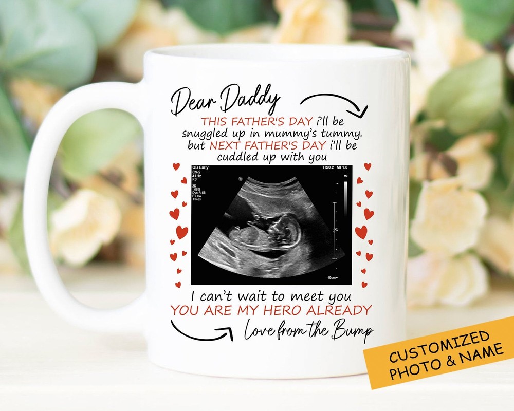 Dear Daddy Personalized Mug Custom Ultrasound Mug Fathers Day Gift New Baby Gift