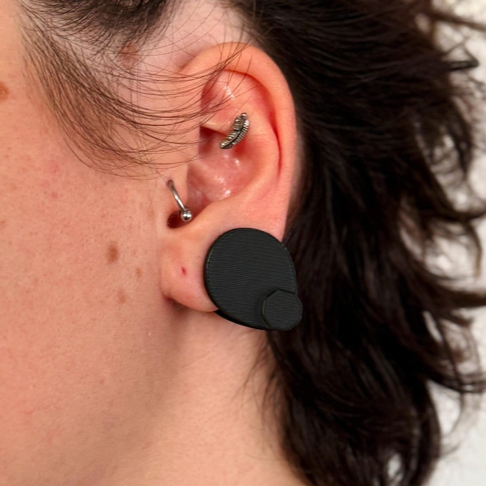 Keloid Compression Earring Disc for Post-Surgery Scar Treatment