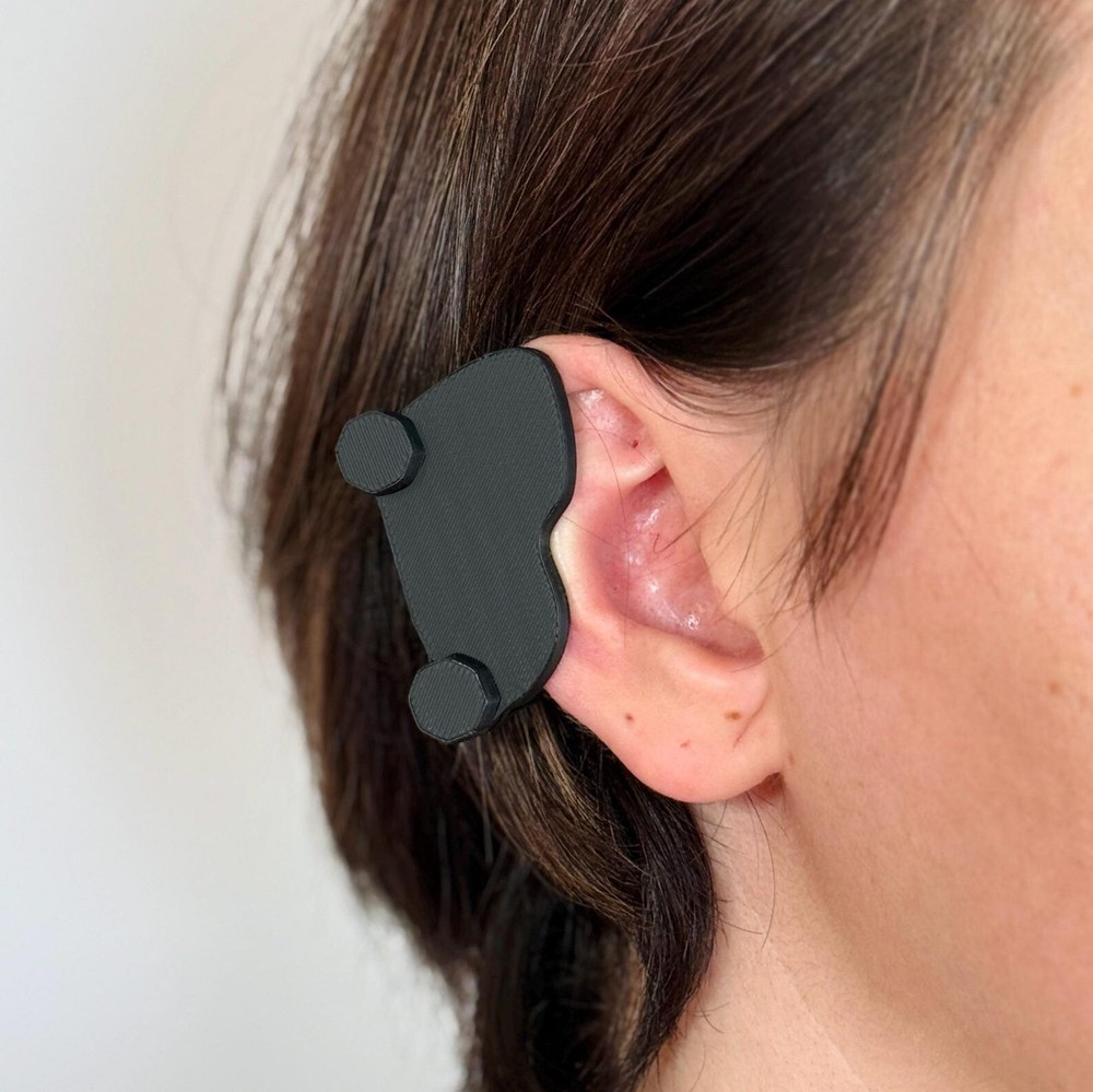 Keloid Compression Earring for Post-Surgery Scar Treatment with Full Pressure