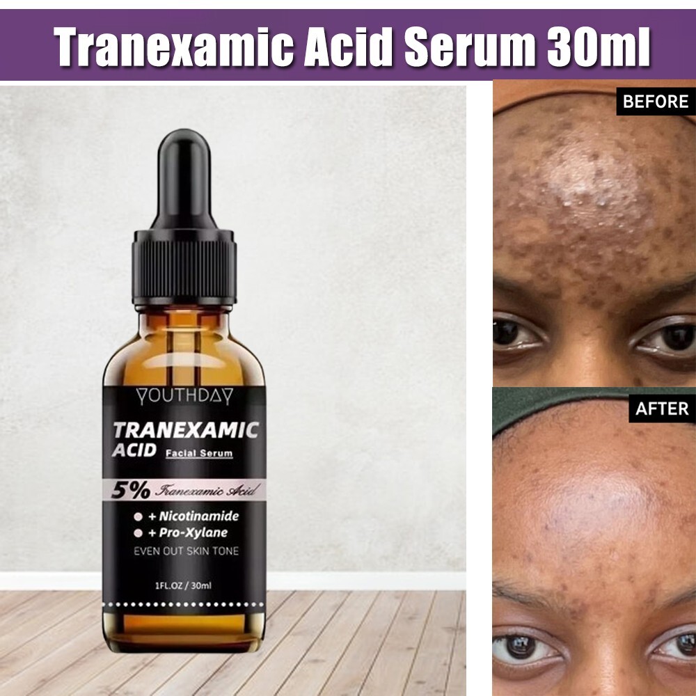 Brightening Tranexamic Acid 5% Serum for Melasma & Dark Spots Fast Results