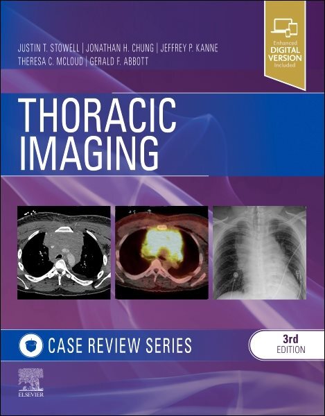 Thoracic Imaging : Case Review, Paperback by Abbott, Gerald F.; Chung, Jonath...