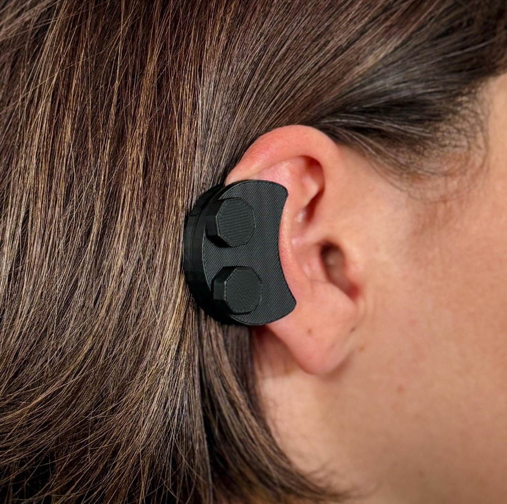 Keloid Compression Earring for Post-Surgery Helix Scar Treatment