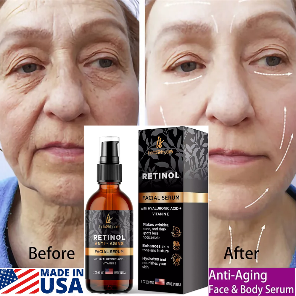 #1 BEST Anti Aging Retinol Serum Hyaluronic Acid