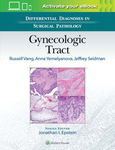 Differential Diagnoses in Gynecologic Surgical Pathology by Vang - Used