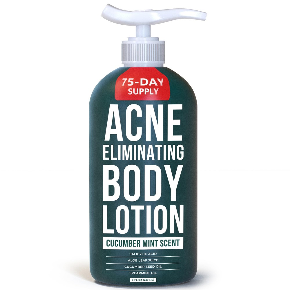Acne Eliminating Body Lotion, 8 fl oz, Salicylic Acid Lotion, Salicylic Acid ...
