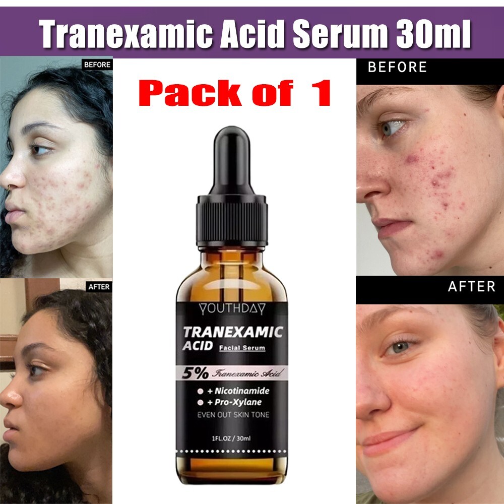 TRANEXAMIC ACID 5% SERUM FOR DARK SPOTS 1 FL OZ