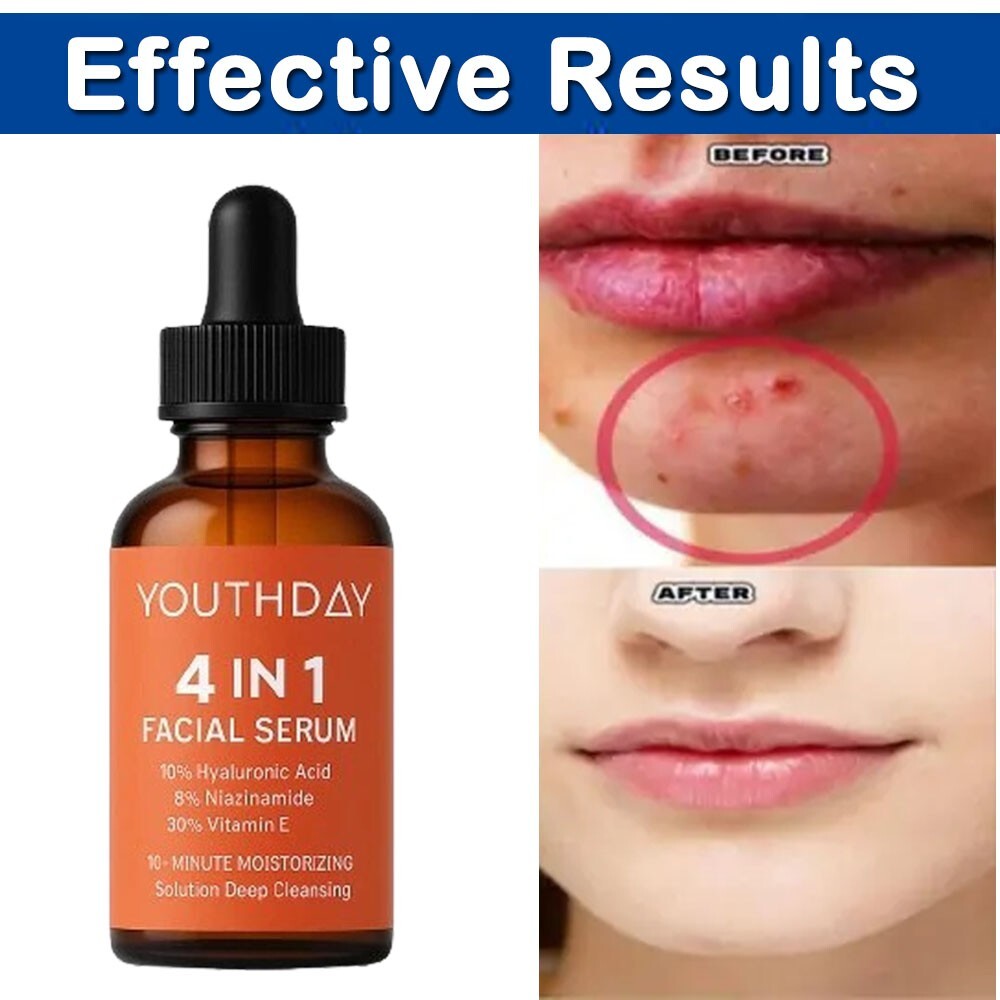Niacinamide Serum with Hyaluronic Acid Vitamin A E and Aloe Vera for Anti-Aging Face Care