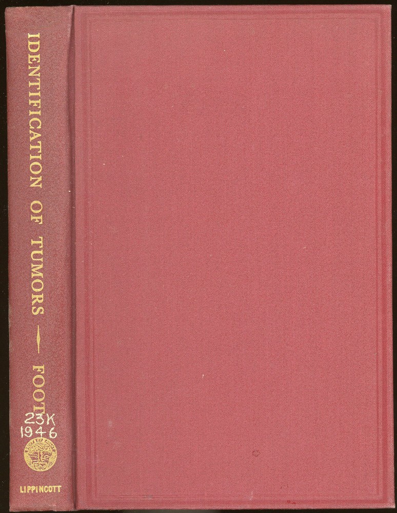 vintage Medical. IDENTIFICATION OF TUMORS by Foot. 1948.