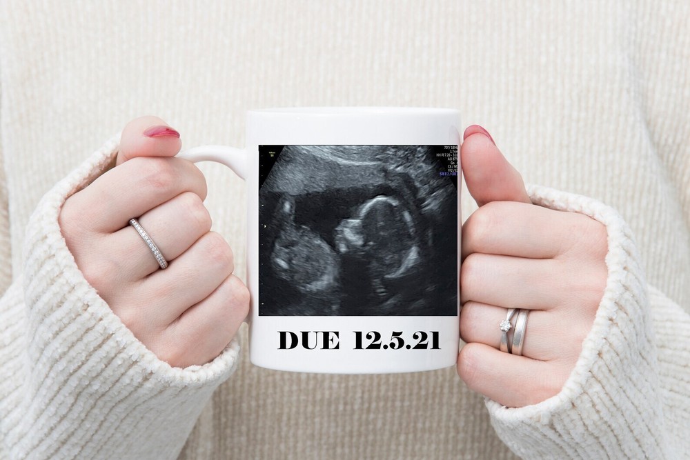 Baby Scan Photo Mug 11oz Mug Tea Coffee Gifts For Everyone Cup
