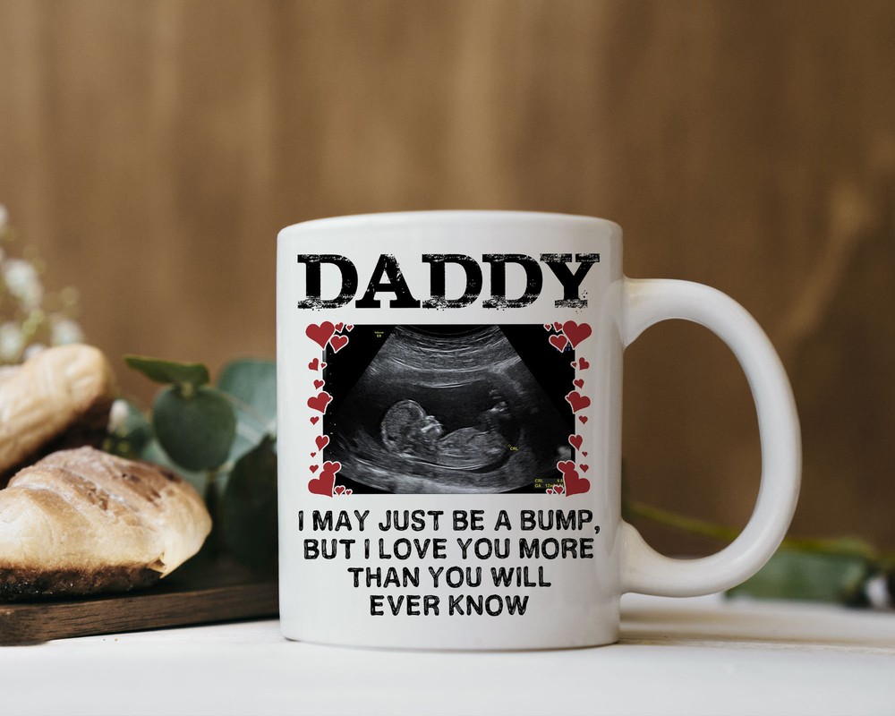 Personalized Ultrasound Photo Mug First Fathers Day Gift Fathers Day Mug Gift