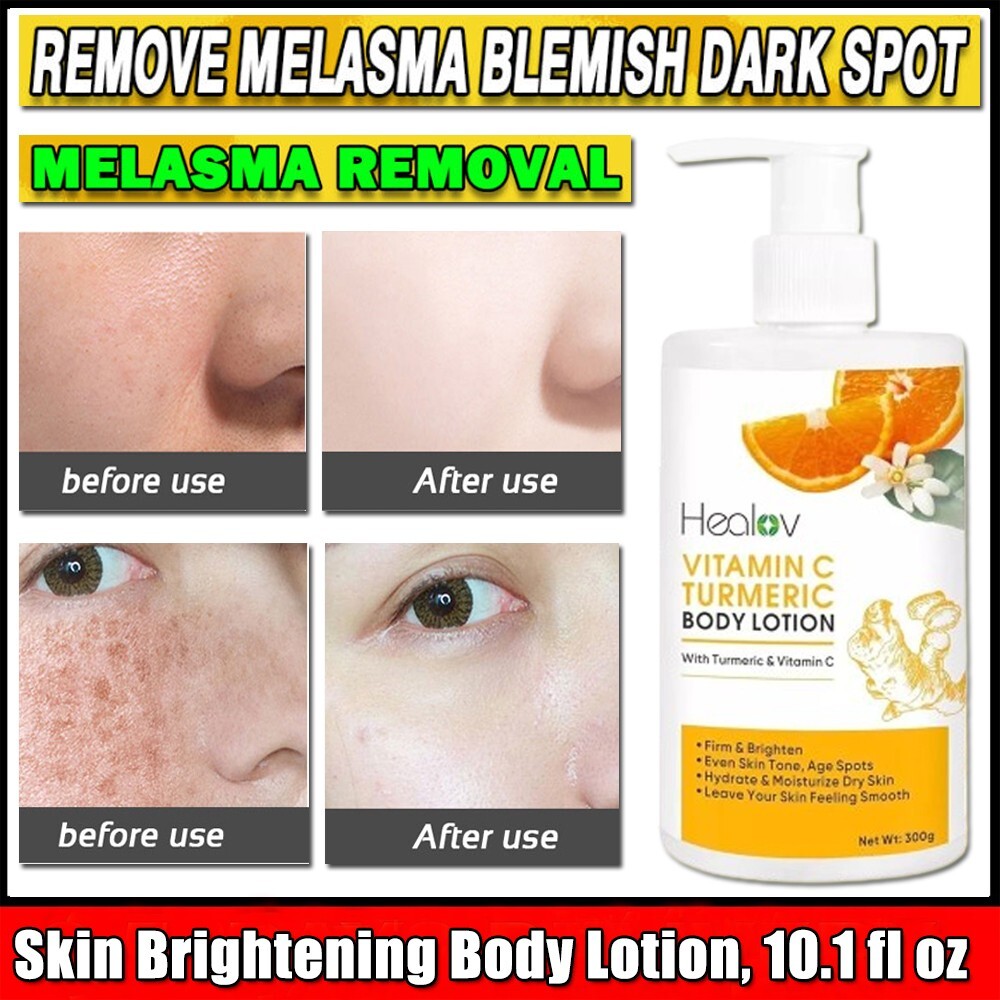 Turmeric Super Whitening Lotion Dark spots Body Corrector 300ml