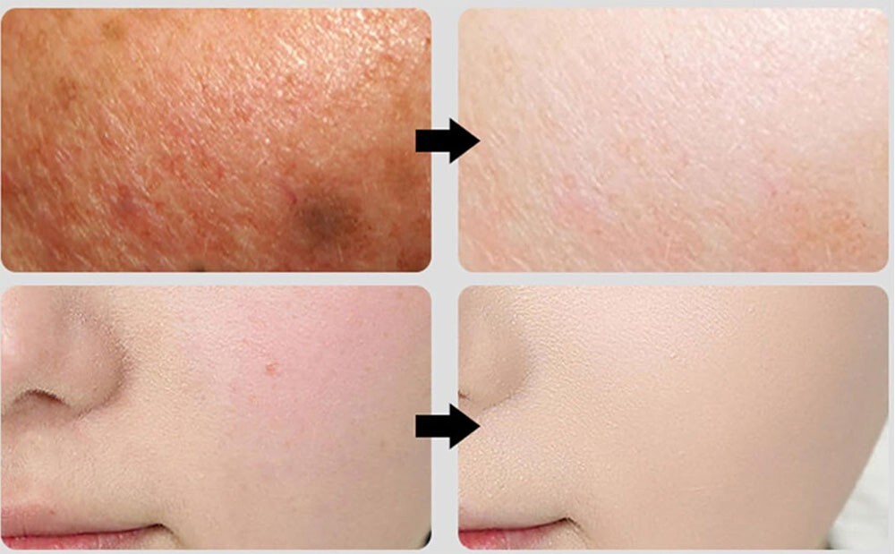 Hyaluronic Acid Hydrating Serum 1 fl oz for Plump Glowing Skin